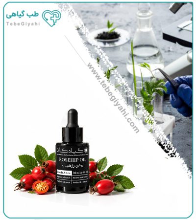روغن رزهیپ مخصوص مو